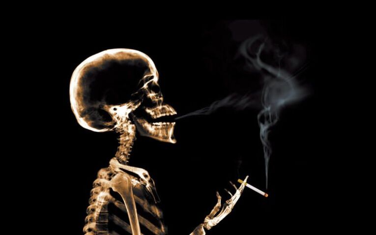 пушењето како причина за болки во грбот во пределот на лопатките