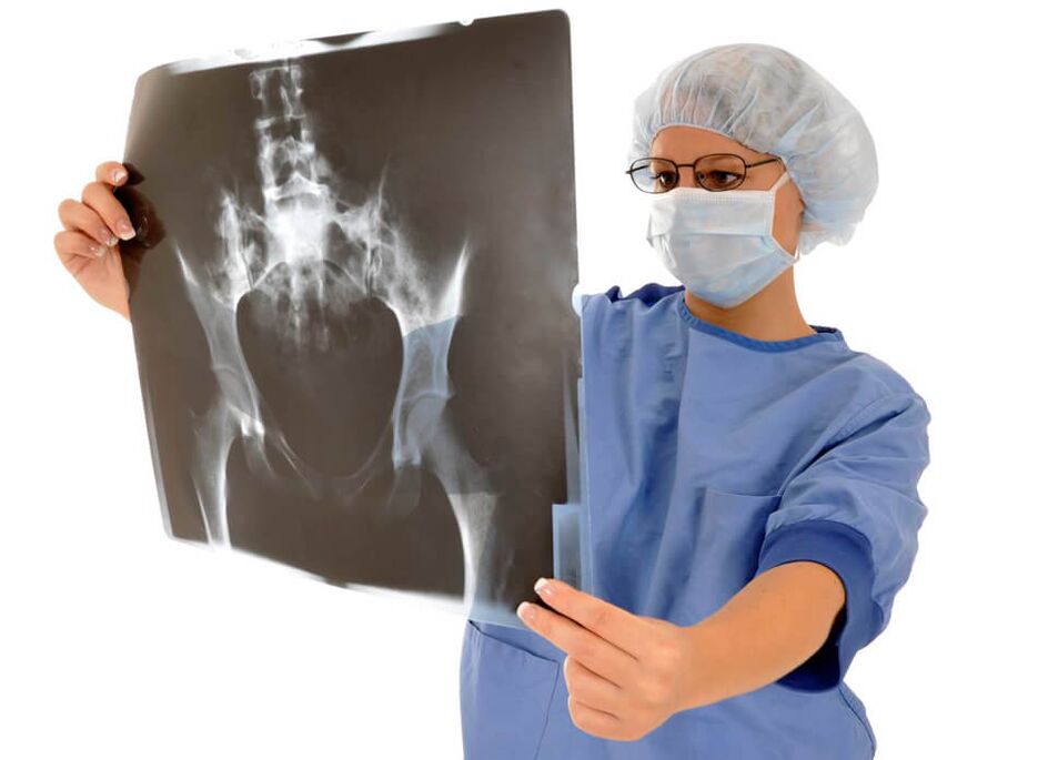 Х-зраци на зглобот на колкот ќе му помогне на лекарот да ја утврди причината за болката
