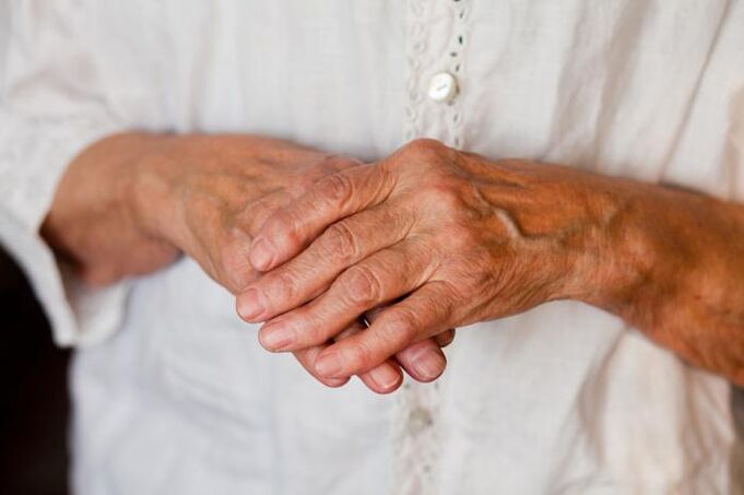 Болката во зглобовите на рацете често им пречи на постарите луѓе