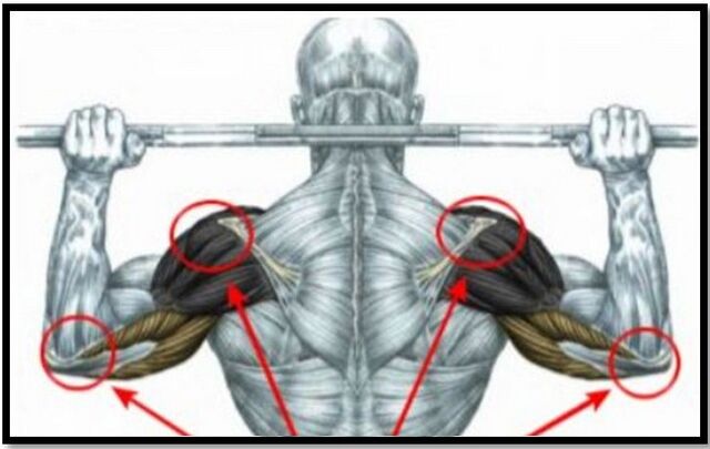 Оптоварувањето на мускулите на рамото и лактот е една од причините за артроза на рамениот зглоб